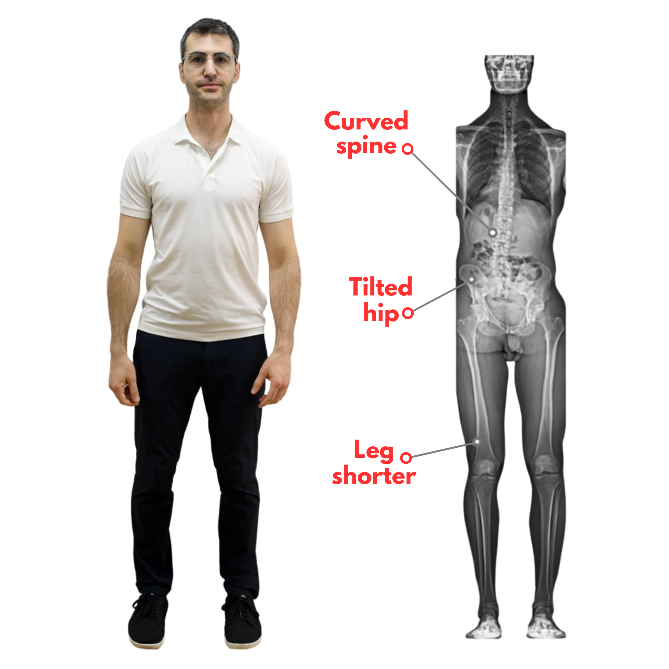 Adonis standing for EOS scan